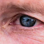 What Causes Wrinkles? 8 Reasons